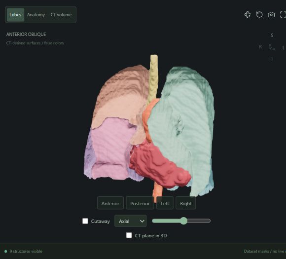 Actual workspace preview showing CT-derived lung lobes, heart envelope and major vessels
